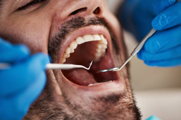 Best Dentist for Tooth Abscess  in Orting, WA