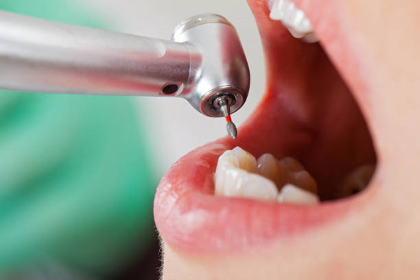 Best Urgent Tooth Repair  in Orting, WA